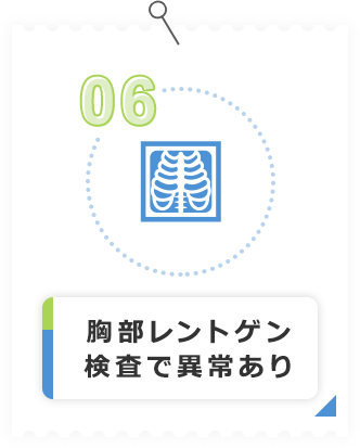 胸部レントゲン検査で異常あり