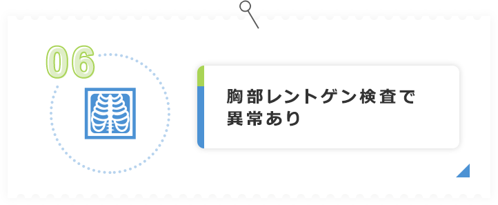 胸部レントゲン検査で異常あり